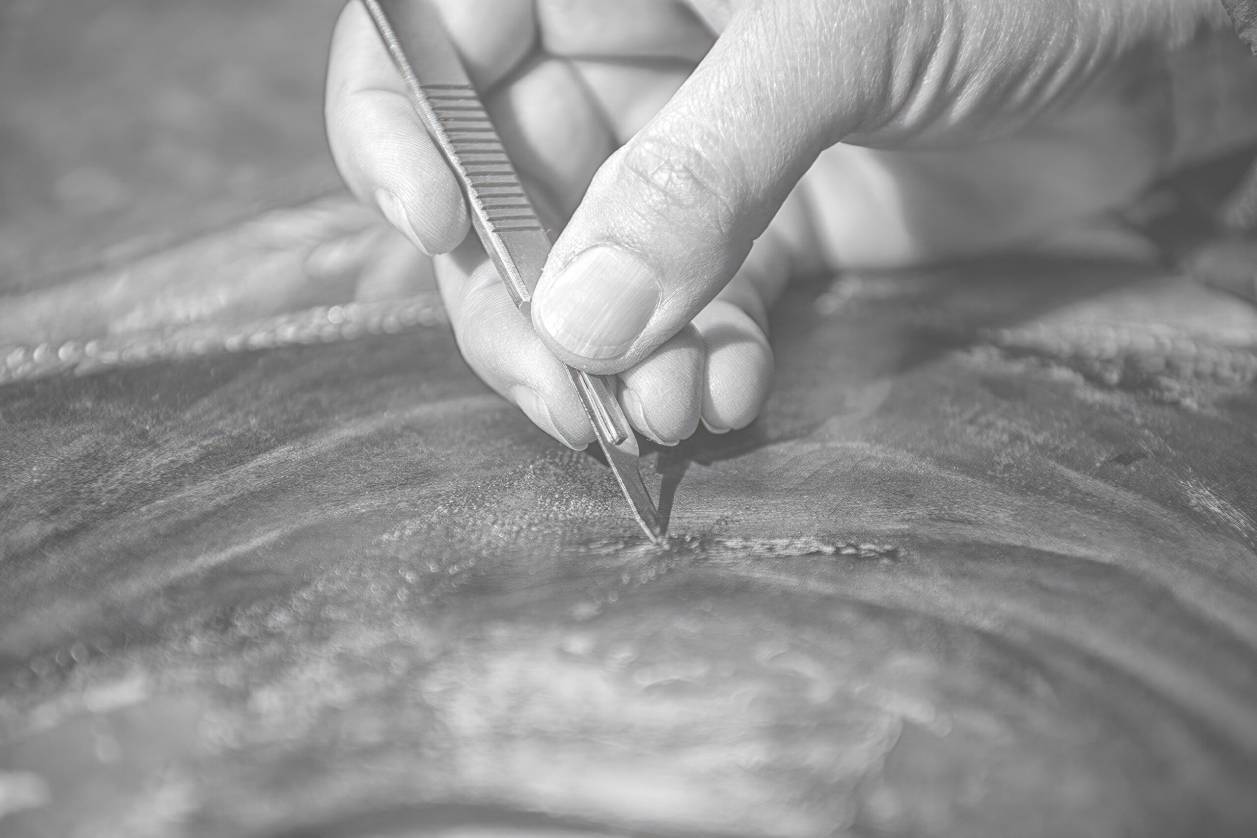 Beyond the Scalpel: How Innovative MedTech is Redefining Healthcare in June 2025